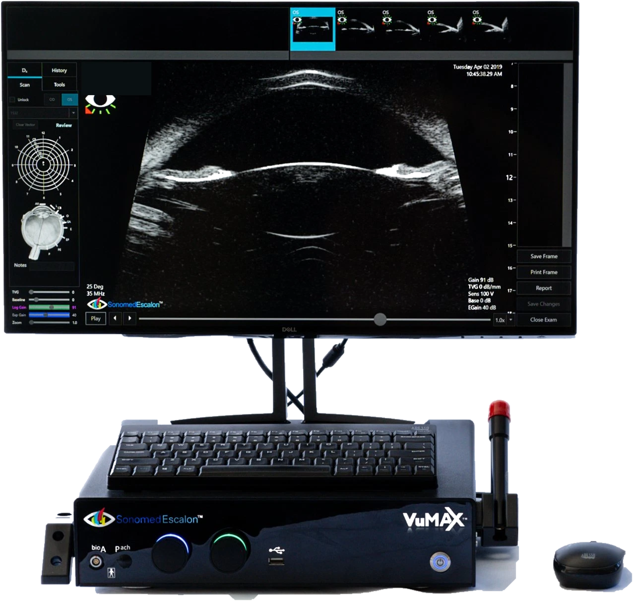 Sonomed Escalon VuMAX HD ophthalmic ultrasound system